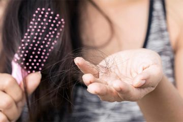 Top 5 địa chỉ chữa rụng tóc uy tín hàng đầu tại Hà Nội