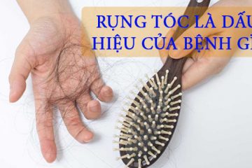 [Giải Đáp]: Rụng tóc là dấu hiệu của bệnh gì?