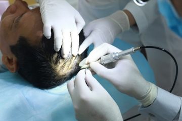 Ai đã từng đi cấy tóc? – Điểm mặt những người nổi tiếng