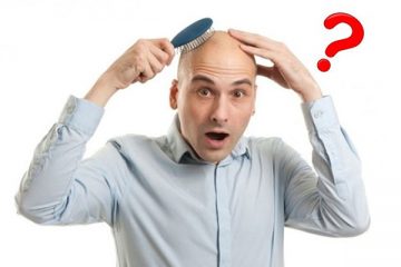 Giải đáp thắc mắc: Bị hói đầu có chữa được không?