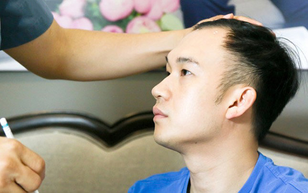 Chi phí cấy tóc ở Việt Nam giá bao nhiêu có đắt không  Phòng khám cấy tóc  quốc tế
