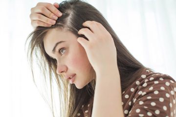 Hói đầu ở phụ nữ – Nguyên nhân và cách điều trị hiệu quả