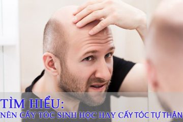 Nên Cấy Tóc Sinh Học hay Cấy Tóc Tự Thân?