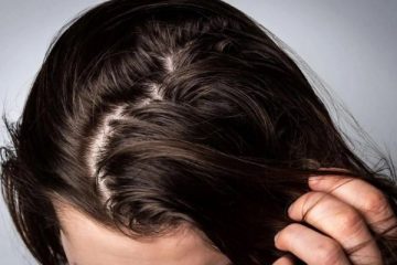 Mách bạn top những cách khắc phục tóc nhiều dầu cực hiệu quả