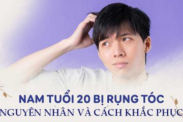 Rụng tóc ở nam tuổi 20: Nguyên nhân và cách điều trị hiệu quả nhất