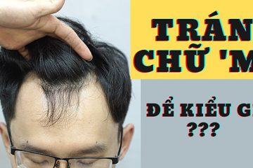 Top 5 kiểu tóc cho người trán chữ M nam hot nhất hiện nay