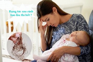[Có thể bạn muốn biết] Rụng tóc sau sinh bao lâu thì hết ?