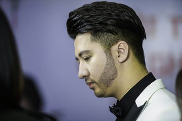 [Có thể bạn muốn biết] Cấy râu có ưu điểm gì?