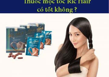 [ Tìm Hiểu ] :  Thuốc mọc tóc Ric Hair có tốt không?