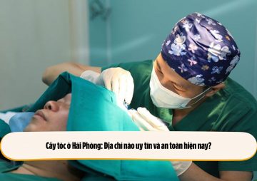 Cấy tóc ở Hải Phòng: Địa chỉ nào uy tín và an toàn hiện nay?