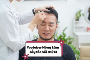 Youtuber Hùng Lâm cấy tóc hói chữ M: Chia sẻ thẳng thắn của người trong cuộc