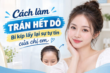 Cách làm trán hết dô – Bí kíp lấy lại sự tự tin của chị em