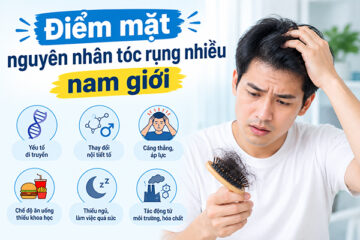 Điểm mặt nguyên nhân tóc rụng nhiều nam giới – Bạn có biết!