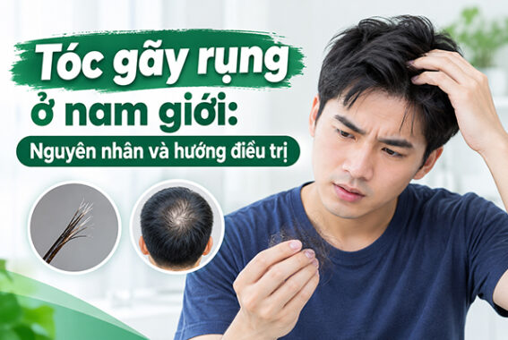 Tóc gãy rụng ở nam giới: Nguyên nhân và hướng điều trị