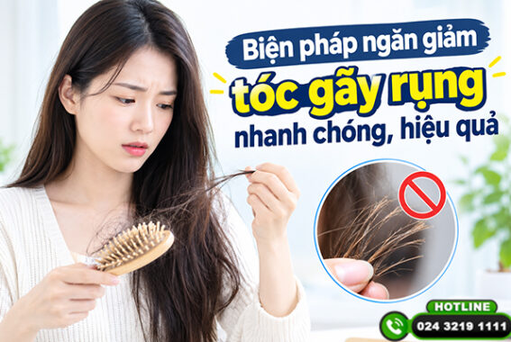 Biện pháp ngăn giảm tóc gãy rụng nhanh chóng, hiệu quả – Đừng bỏ lỡ!