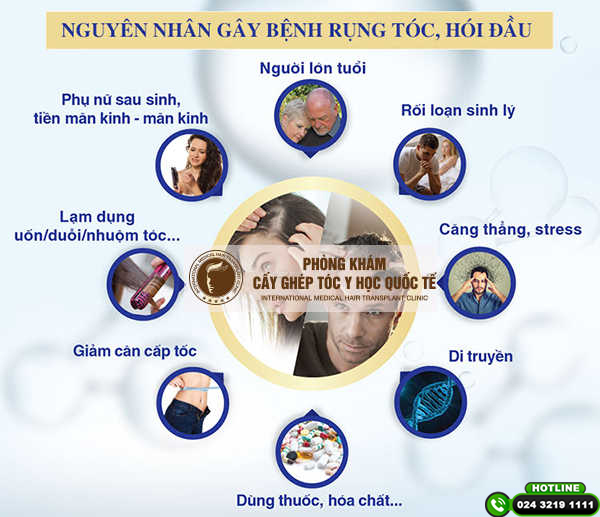 nguyên nhân bị đầu hói
