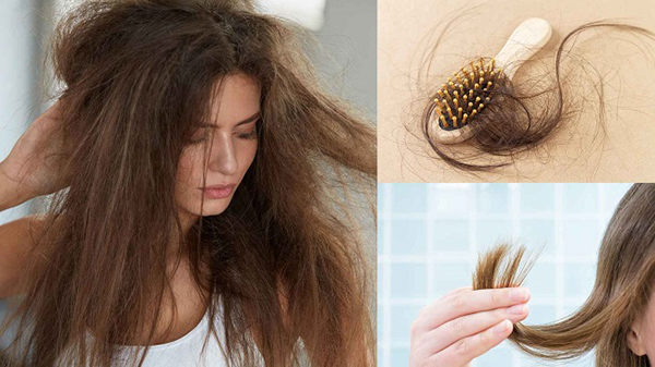 NGuyên nhân rụng tóc ở con gái