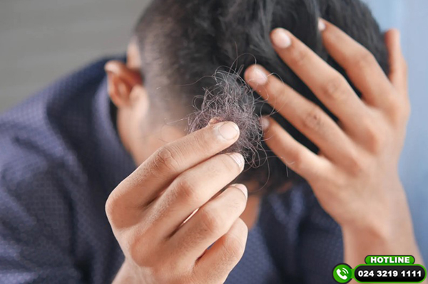 Đàn ông bị rụng tóc - Nguyên nhân và cách khắc phục hiệu quả